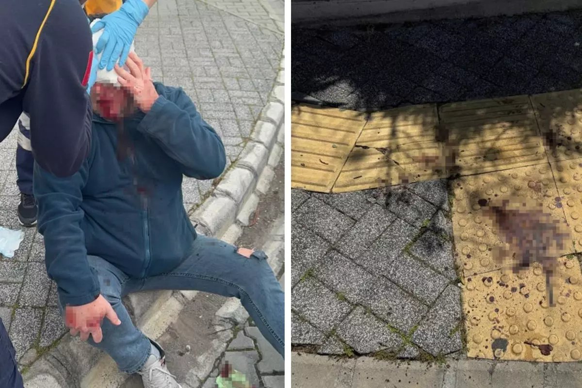 marmariste-gazeteciye-saldiri-da-5-kisi-gozaltina-alindi-q7lP7YhK.jpg