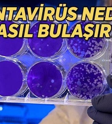 HANTAVİRÜS NASIL BULAŞIR, NASIL YAYILIR? Hantavirüs insandan insana bulaşır mı, belirtileri nelerdir?